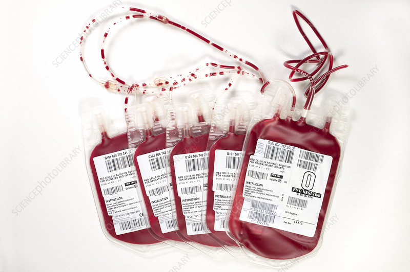 Blood bags containing O negative blood for neonate (newborn) babies and infants. Babies need less blood than adults, so only 55ml of blood is in these bags, about four times smaller than the volume of an adult blood bag. The donor blood has been through a process of separation and mixing of its component parts to optimise its use. The blood group and type needs to be matched to that of the baby in need. Infant blood transfusions are mainly used to replace lost blood due to an injury or during surgery.